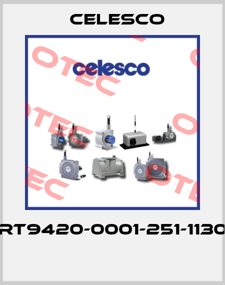 RT9420-0001-251-1130  Celesco